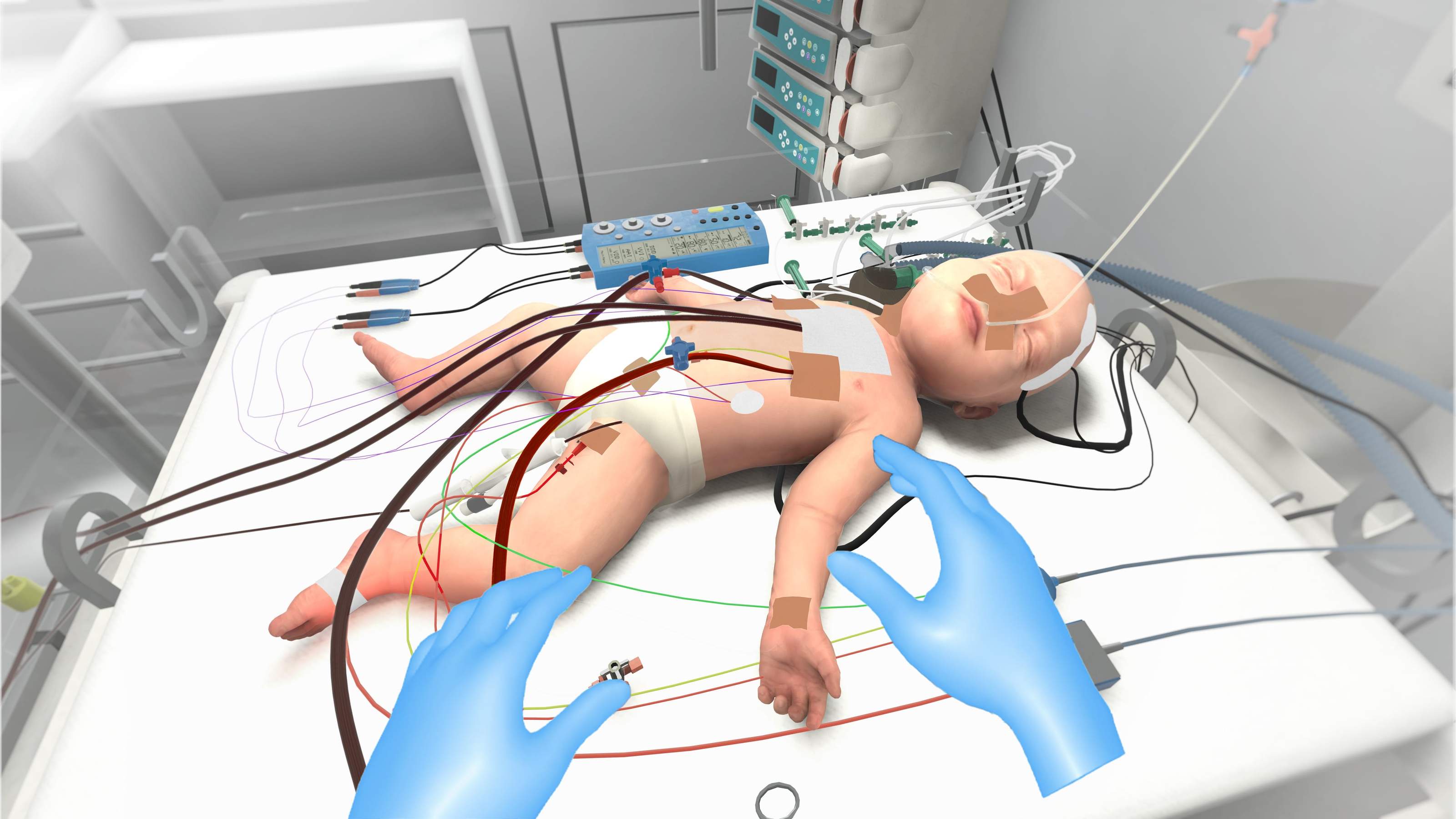 Digital twin of a baby with ECMO cannulas, gloved hands examine the patient in VR